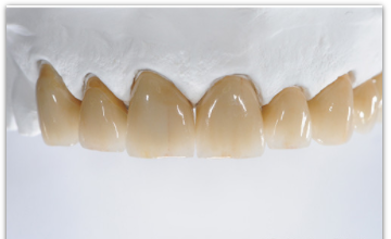 Cosmetic dentistry