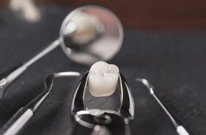 Replace Damaged Teeth