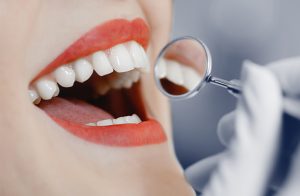 Cosmetic Dentist Melbourne CBD